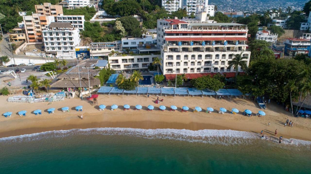 Acamar Beach Resort アカプルコ エクステリア 写真